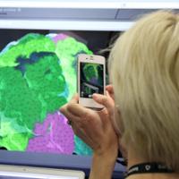 The Virtual Brain at SfN in San Diego